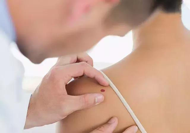 肿瘤标志物有几项,肿瘤红色