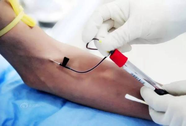 抽血抽到手麻护士,抽血护士把你手抽淤青怎么办