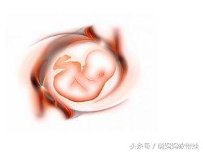 怀孕肺结核对胎儿有什么影响,孕妇得了肺结核对胎儿有影响吗