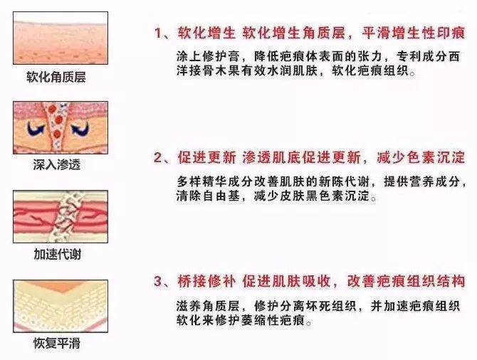 去疤小妙招不弄药水,祛疤小方法