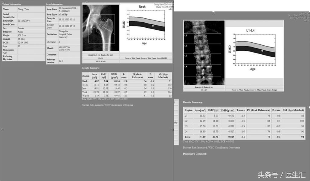 pagets能彻底治愈吗,pagets可以彻底治愈吗