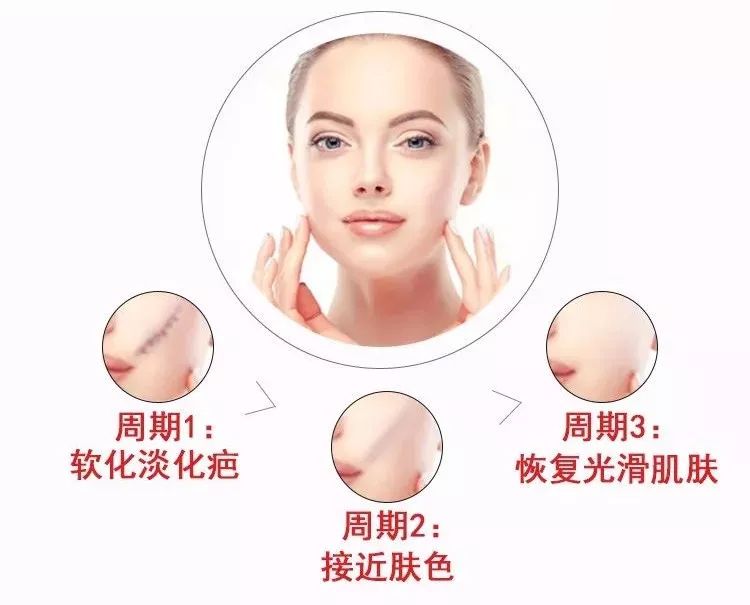 去疤小妙招不弄药水,祛疤小方法