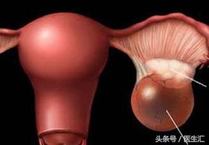 肚子绞痛并且鼓包怎么回事,卵巢囊肿腹痛说明破裂了吗