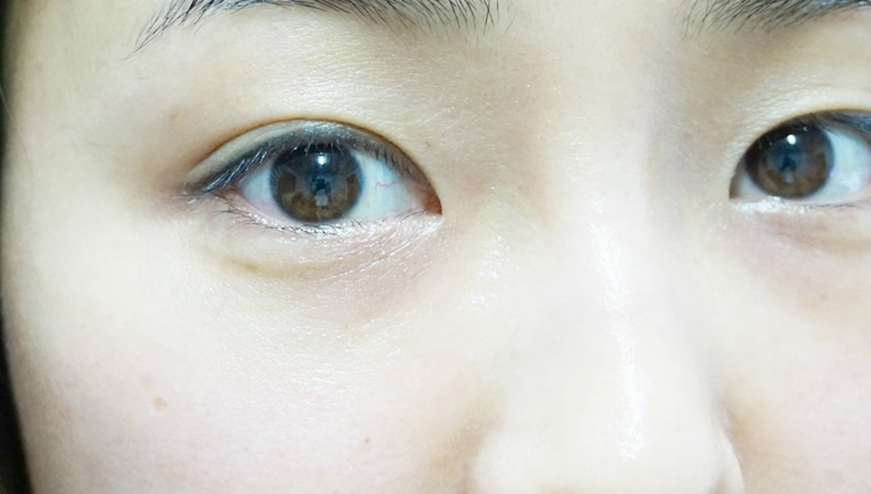 脸上干燥起皮怎么样才能快速补救,化妆干燥起皮