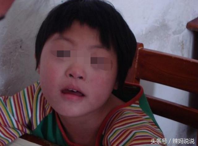 七岁女儿老说头疼怎么回事,7岁女孩一直说头疼