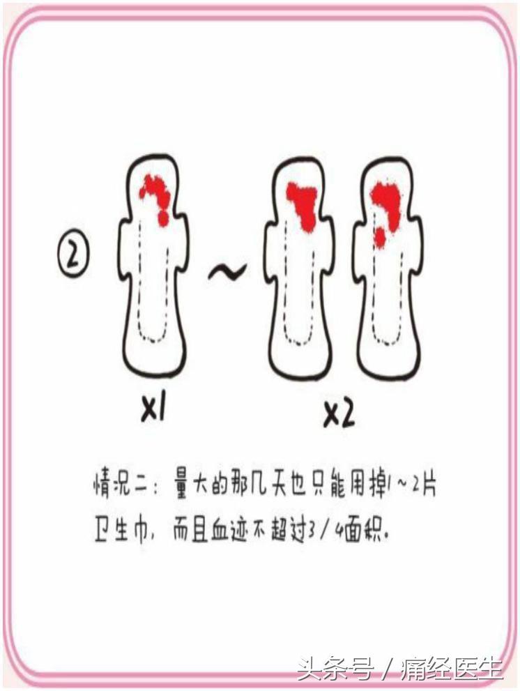 正常月经的5个标准赶紧对照一下,如何知道自己的月经量是否正常