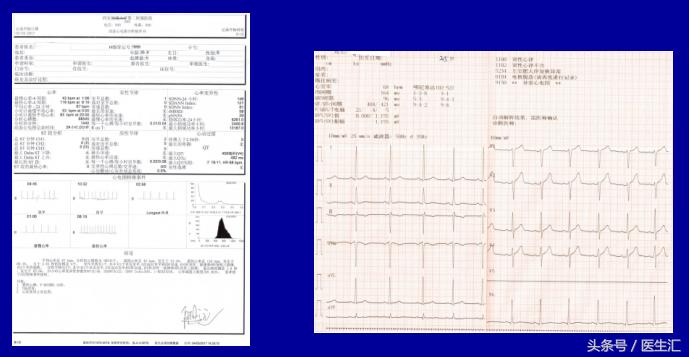 高血压一般超过多少才算高血压,35岁以上人群高血压发病率