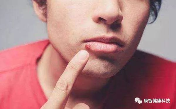 妇科上火什么方法有效降火,女性易上火咋调理