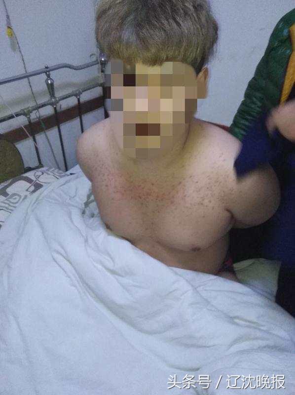 女子麻醉抢劫案件,女子麻醉抢劫被抓