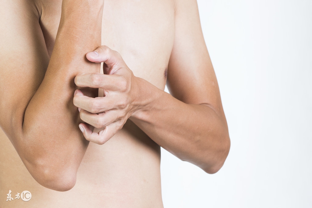 皮肤瘙痒的中医辨证治疗,大腿沟湿热瘙痒中医辨证