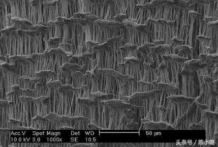 隆鼻假体和膨体哪种好,膨体隆鼻的选择