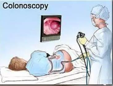 肛门指检，被人“*菊爆**”是种什么体验？痛并快乐，还有一点点舒服