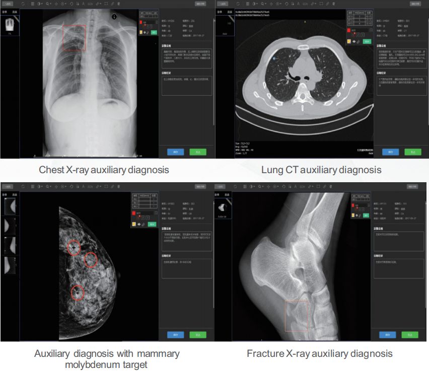 医疗ai成像,医疗影像AI第一股