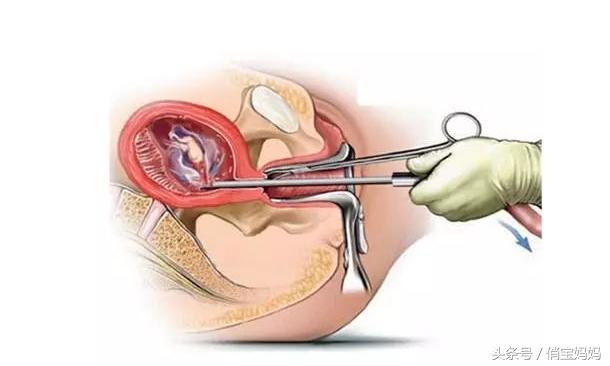 有了宝宝却不能要的心情,有了宝宝如何省钱