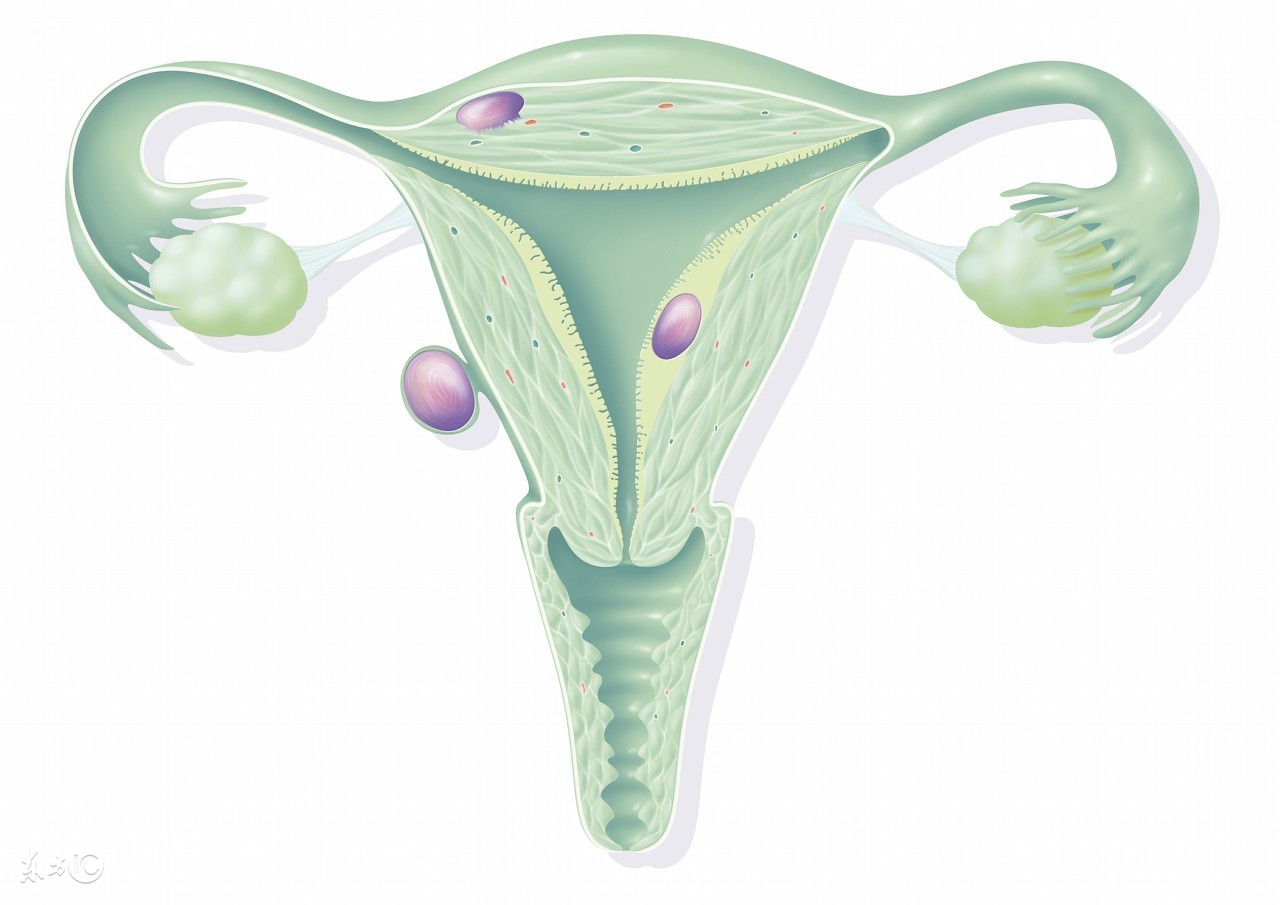 小肚子大是不是子宫肌瘤,子宫肌瘤手术后肚子是硬的吗