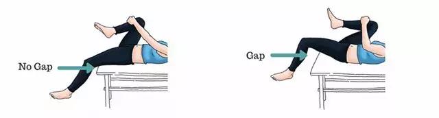 骨盆后倾的自我矫正方法,骨盆后倾怎样自己矫正