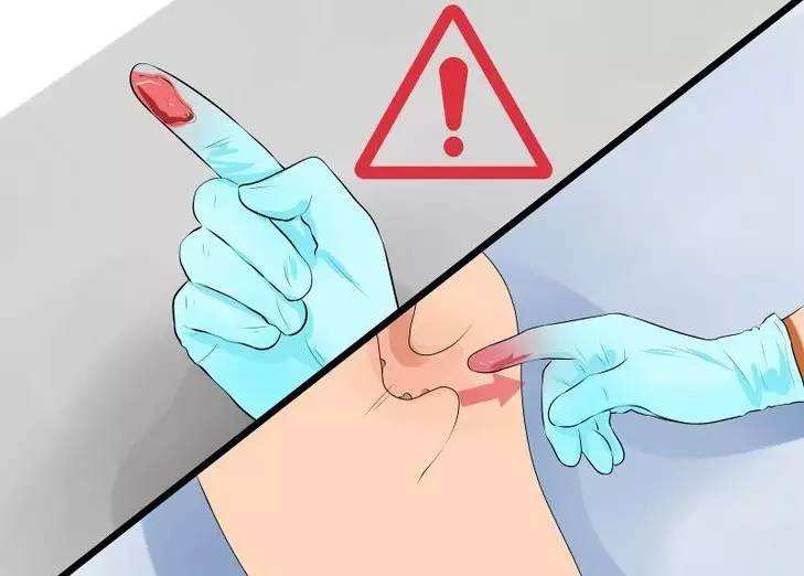 肛门指检，被人“*菊爆**”是种什么体验？痛并快乐，还有一点点舒服