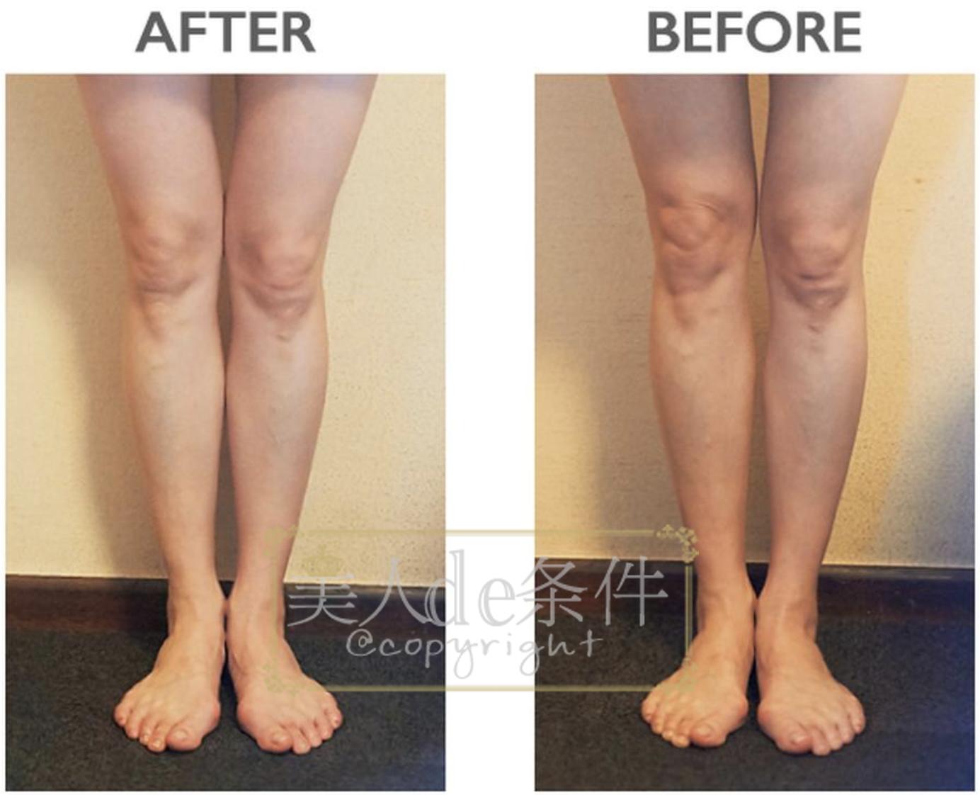 林允晒医美照还嫌贵？谁让她不了解隔壁岛国的医美全攻略