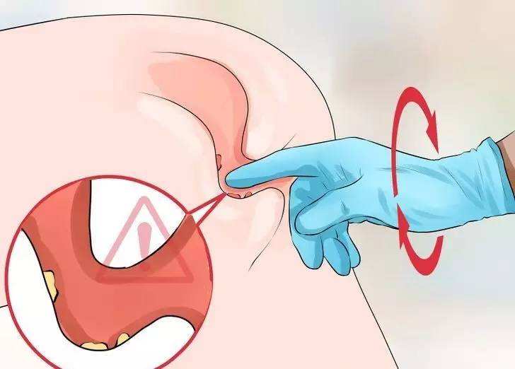 肛门指检，被人“*菊爆**”是种什么体验？痛并快乐，还有一点点舒服