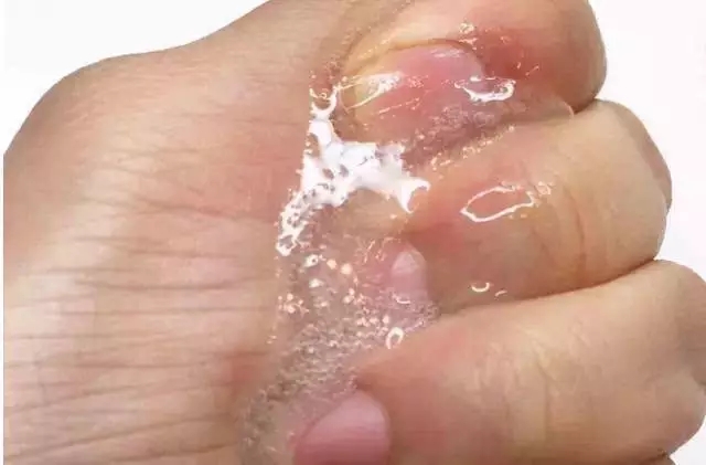 医用面膜测评,高姿面膜测评