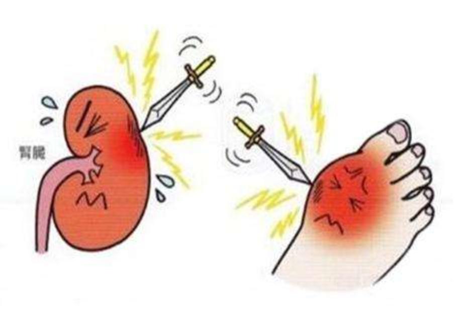 青少年尿酸高痛风怎么办,青少年尿酸高自愈后还需要忌口吗