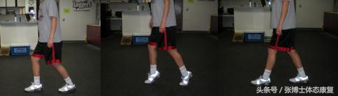 崴脚怎么避免习惯性扭伤,踝关节扭伤一直崴脚怎么办