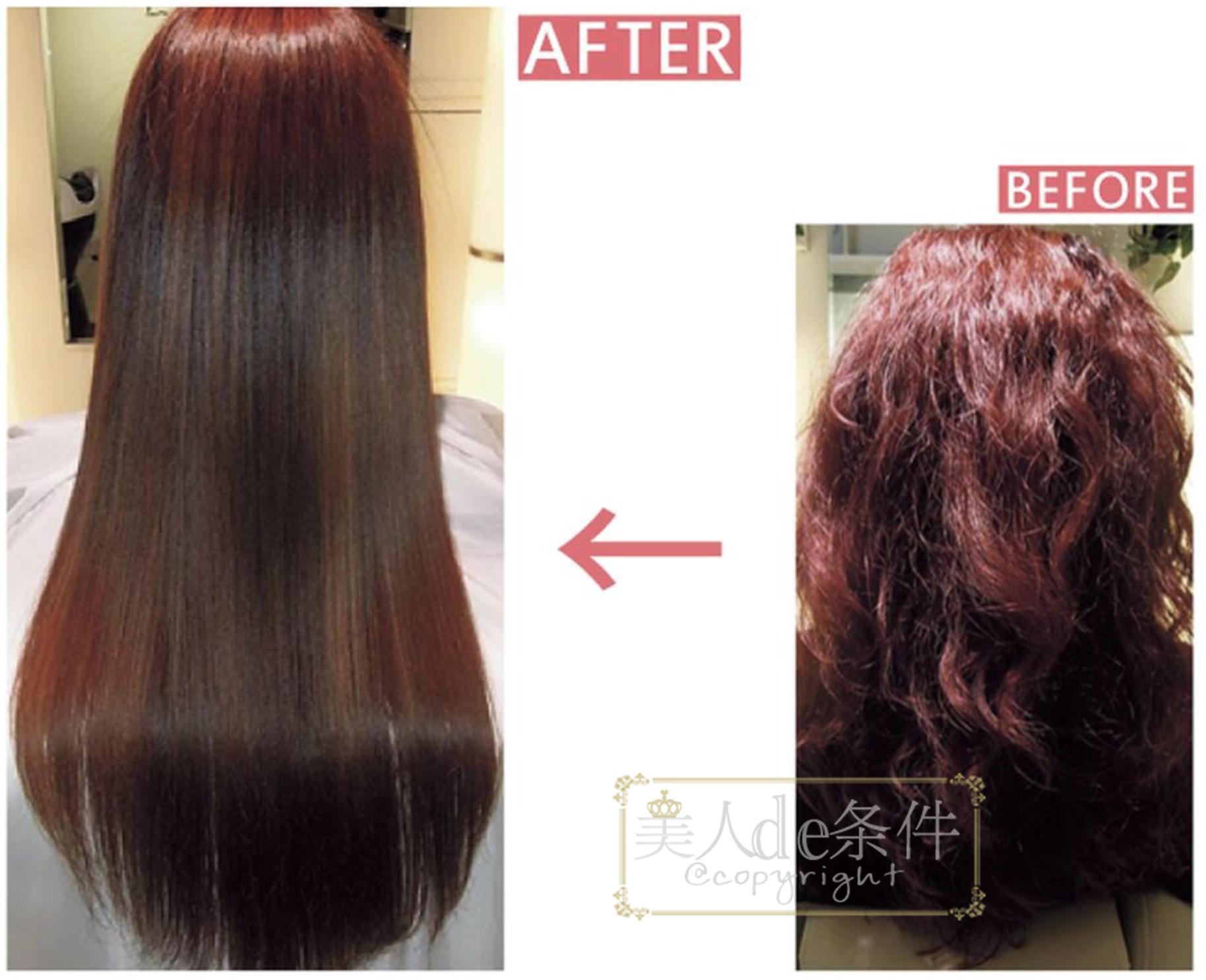 林允晒医美照还嫌贵？谁让她不了解隔壁岛国的医美全攻略