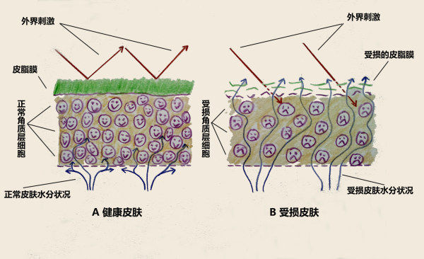 干性皮肤水乳敏感,干性皮肤缺水泛红敏感怎么办