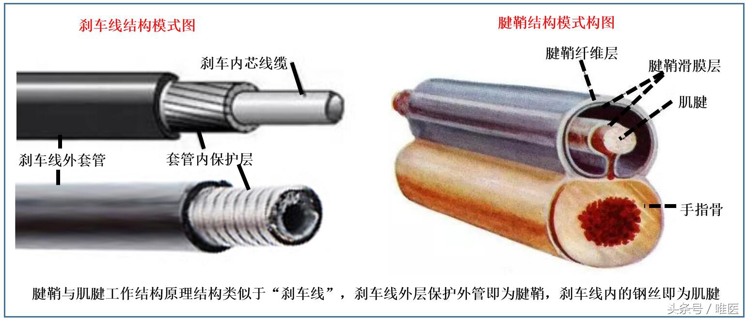 腱鞘炎治疗过程疼到尖叫视频,腱鞘炎跳一跳