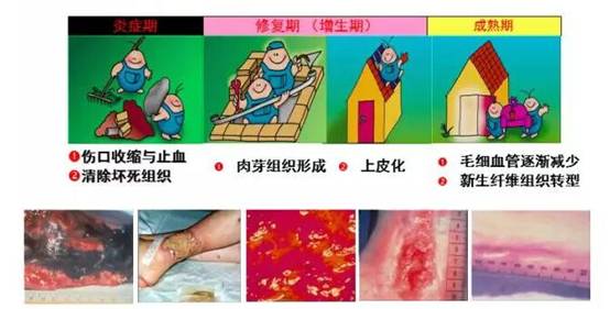 糖尿病足部皮肤护理,糖尿病患者皮肤溃烂治疗