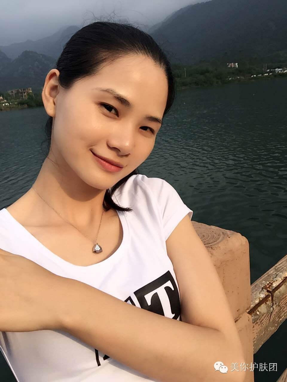 体内严重上火长痘怎么去,拒绝熬夜恢复新陈代谢