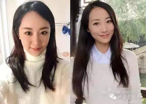 烂演技不可怕整容脸才尴尬,盘点影视剧的整容脸