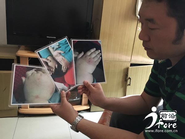 塔元庄幼儿园老师针扎幼童,红黄蓝幼儿园针扎幼童