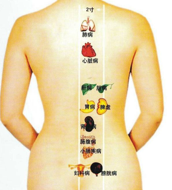 治颈椎病的中医治疗方法,颈椎病的治疗最有效的穴位