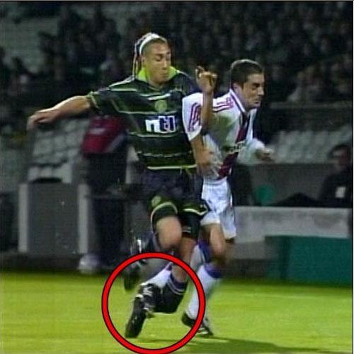 中甲再现断腿惨案,中甲赛场断腿