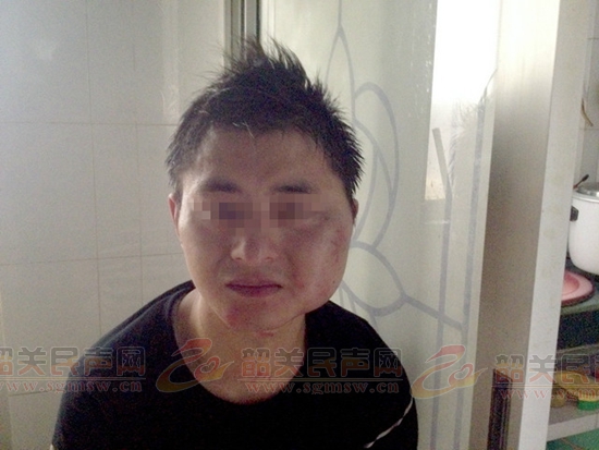 小伙被骗误入传销组织被打回家,男子被骗进传销窝点反击