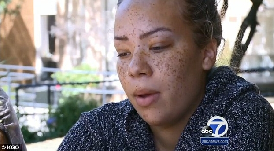 宝宝哭闹不休怎么办?爸爸咬掉儿子的鼻子