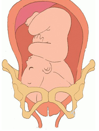 孕妇分娩过程中按肚子,孕妇的分娩过程