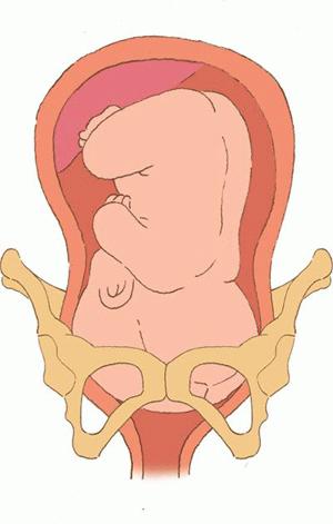 孕妇分娩过程中按肚子,孕妇的分娩过程