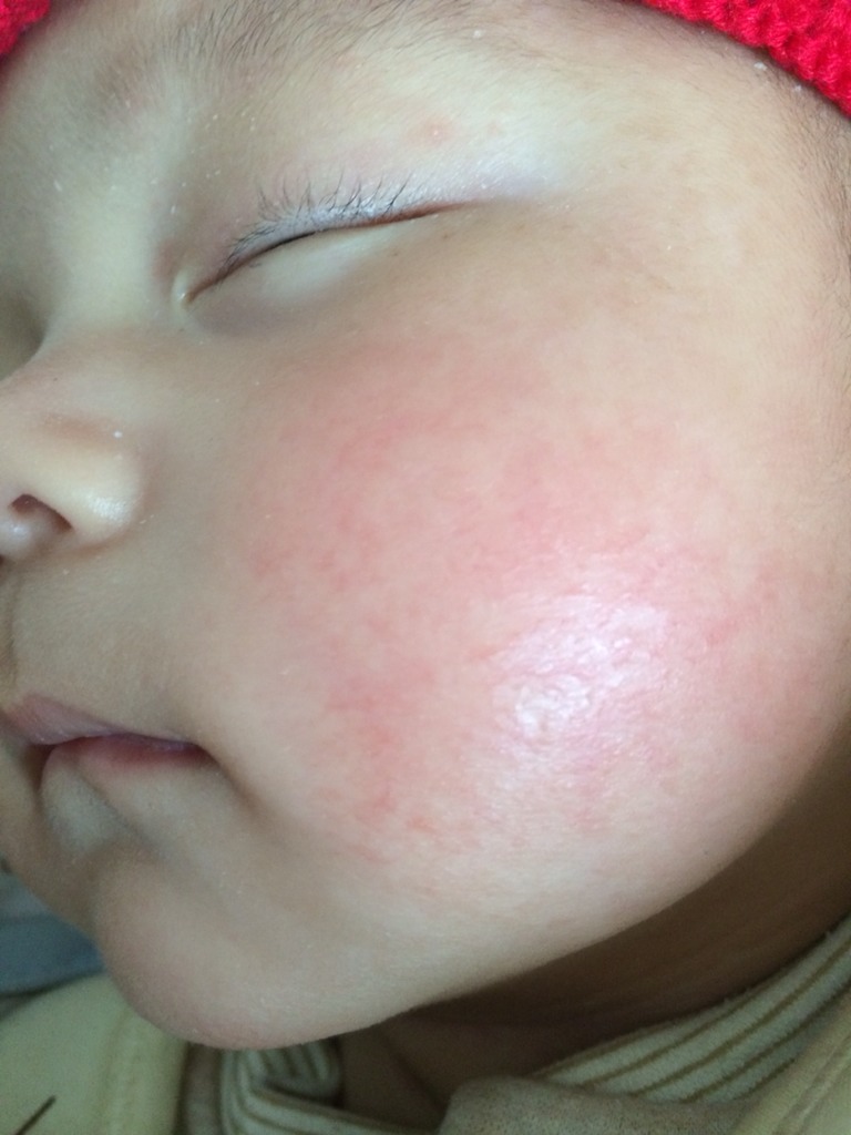 宝宝常见重大疾病有哪些,中老年人常见的十大疾病