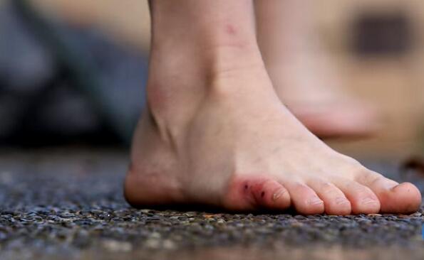 孕妈妈被毒蛇咬，难撑到医院，没想到医生告诉她的选择竟然这么难