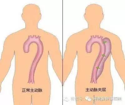 这个病死亡率达到60%，有腹痛时可能就是信号，转发吧
