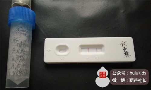 还在为皮肤病发愁吗,宝宝湿疹实际上需要简单应对