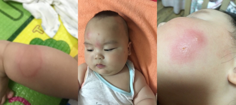 蚊子君夏季,夏季怎样驱赶蚊子避免蚊虫叮咬