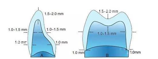 牙医为什么建议做二氧化锆,被牙医骗了的二氧化锆