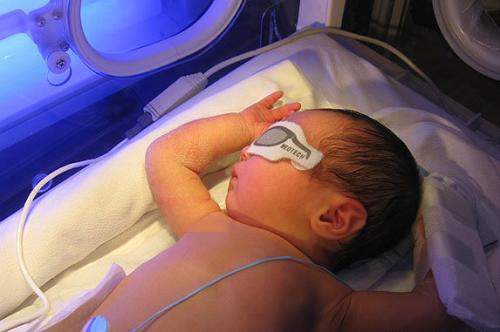 新生儿黄疸住院医生说照ct,带宝宝医院查黄疸说说