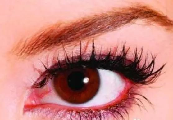 糖尿病眼底出血打什么针最有效,糖尿病眼底出血是什么症状