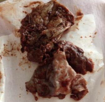 纳尼！产后这么恶心的东西-恶露，小方法搞定它。