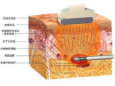 懒人减肥真的可以吗,懒人瘦身有效吗