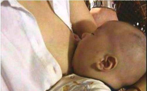 乳孔太小出奶慢怎么办,出乳孔少与乳汁量有关吗